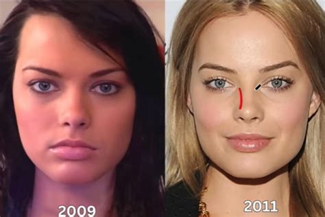 Margot Robbie before and after: The Barbie Plastic Surgery ...